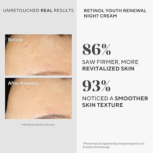 Murad Resurgence Retinol Youth Renewal Night Cream – Anti-Aging Retinol Moisturizer for Wrinkles and Fine Lines – Hydrating, Firming, and Smoothing Skincare Treatment, 1.7 Fl Oz